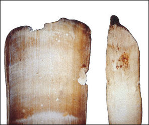 20120207-Otzi Museum whipworm egg evidence.jpg